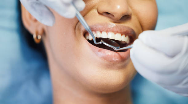 Best Emergency Broken Tooth Repair in West Sharyland, TX