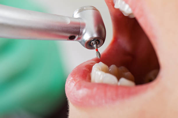 Best Emergency Treatment for Toothache in West Sharyland, TX